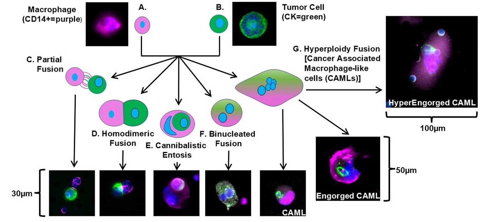 Diagram illustrating five macrophage-tumor cell fusion types, from partial fusion to CAMLs, with fluorescence microscopy examples at 30&ndash;100 &micro;m scale.